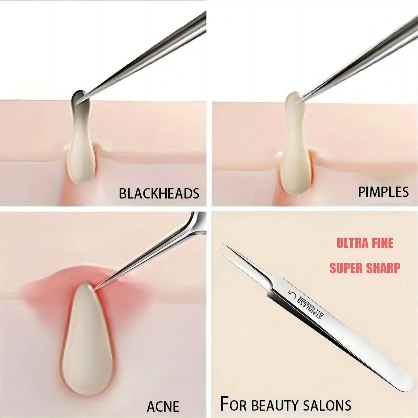 1pc Extra Fine No. 5 Cellular Blackhead Tweezers