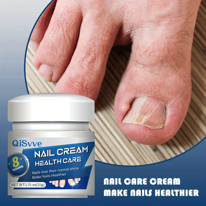 QiSvve 8-Week Nail Care Cream - Salicylic Acid & Plant Extract Formula for Strong, Healthy Fingernails & Toenails, Moisturizing Cuticle Care, Fades Yellowing, Smooths Rough Texture, Formaldehyde-Free, 0.70oz/, Nail Care Produ